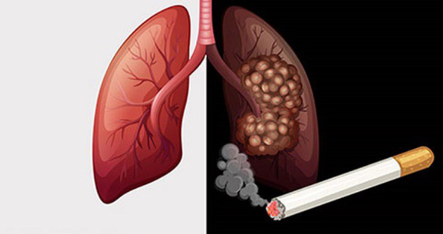 Công thức bảo vệ phổi
